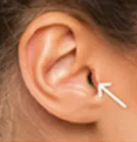 Tragus